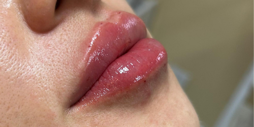 Close-up de lábios hidratados e com contorno natural