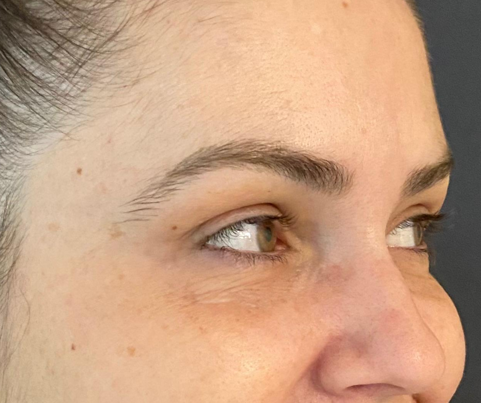 Close-up de olhos com pele suave e expressão descansada